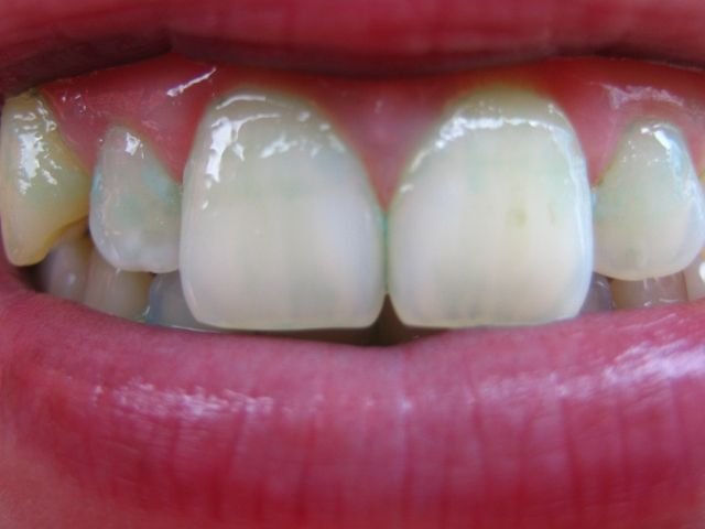 upic64829